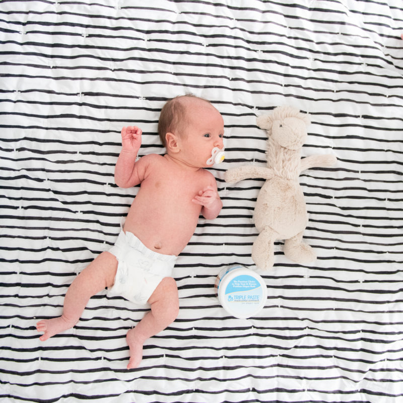 Tips for Getting Rid of Baby Diaper Rash